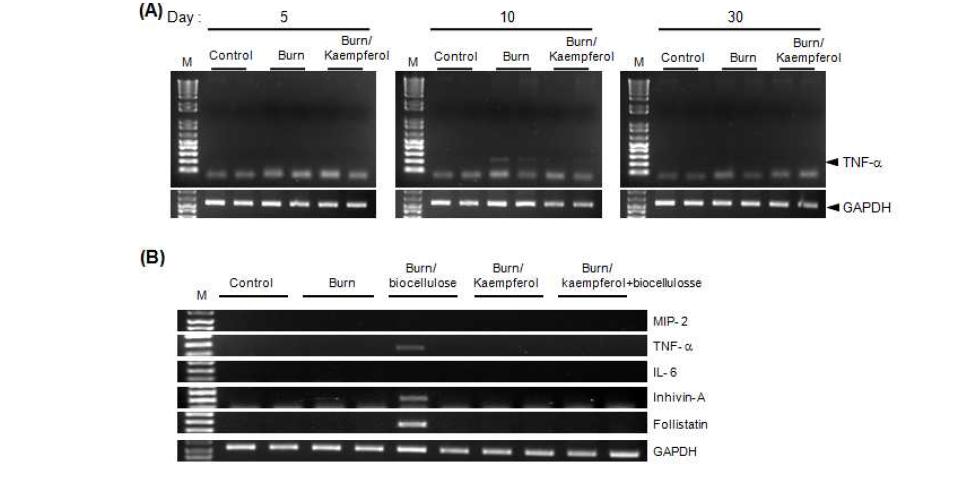 끓는 물로 마우스의 피부에 화상을 유발한 후, 30일 동안 kaempferol을 매일 도포한 마우스의 피부조직에서 RNA를 분리하였음. 싸이토카인등의 primer를 이용하여 RT-PCR을 수행하였음.