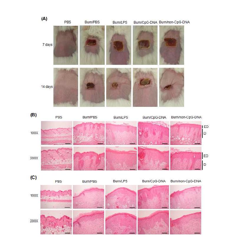 끓는 물로 마우스의 피부에 화상을 유발한 후, 5일 동안 매일 LPS (5 mg/Kg), CpG-DNA (MB-ODN 4531(S)) (2.5 mg/Kg) , 또는 non-CpG-DNA 2041(S) (2.5 mg/Kg)를 도포하고 2일 후 와 9일 후에 마우스의 사진(A) 과 피부 조직을 H&E 염색 (B, C) 결과