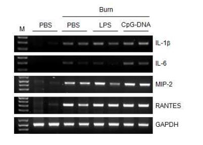 Fig. 13. 끓는 물로 마우스의 피부에 화상을 유발한 후, 5일 동안 매일 LPS (5 mg/Kg), CpG-DNA (MB-ODN 4531(S)) (2.5 mg/Kg)를 도포하고 도포한 마우스의 피부조직에서 RNA를 분리하였음. 싸이토카인등의 primer를 이용하여 RT- PCR을 수행하였음