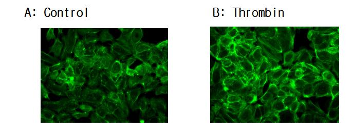 Increase of actin content by thrombin