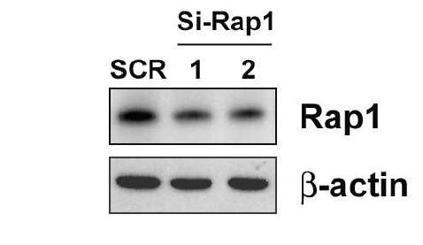 Knockdown of Rap1 by transfection of si-Rap1 into endothelial cells