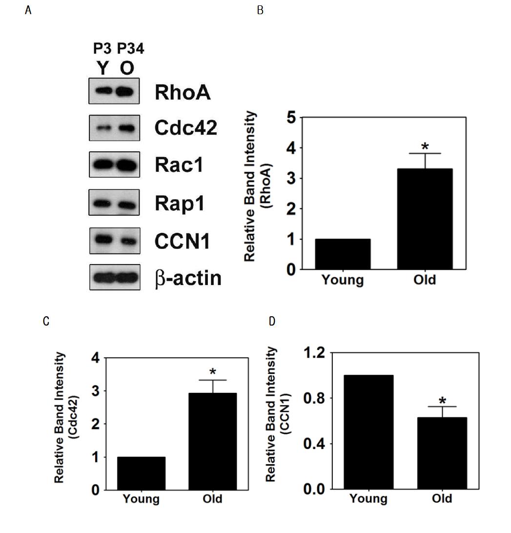 젊은 혈관내피세포와 노화된 혈관내피세포의 RhoA, Cdc42, Rac1, Rap1, CCN1 and β-actin을 western blot으로 확인함