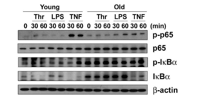 Fig. 27. 젊은 혈관내피세포와 노화된 혈관내피세포를 100 mm dish에 배양한 후, Thrombin, LPS 그리고 TNF-α로 시간별로 자극을 준 뒤, western blot으로 p-p65, p-IκB-α, p65 그리고 I κB-α를 확인함