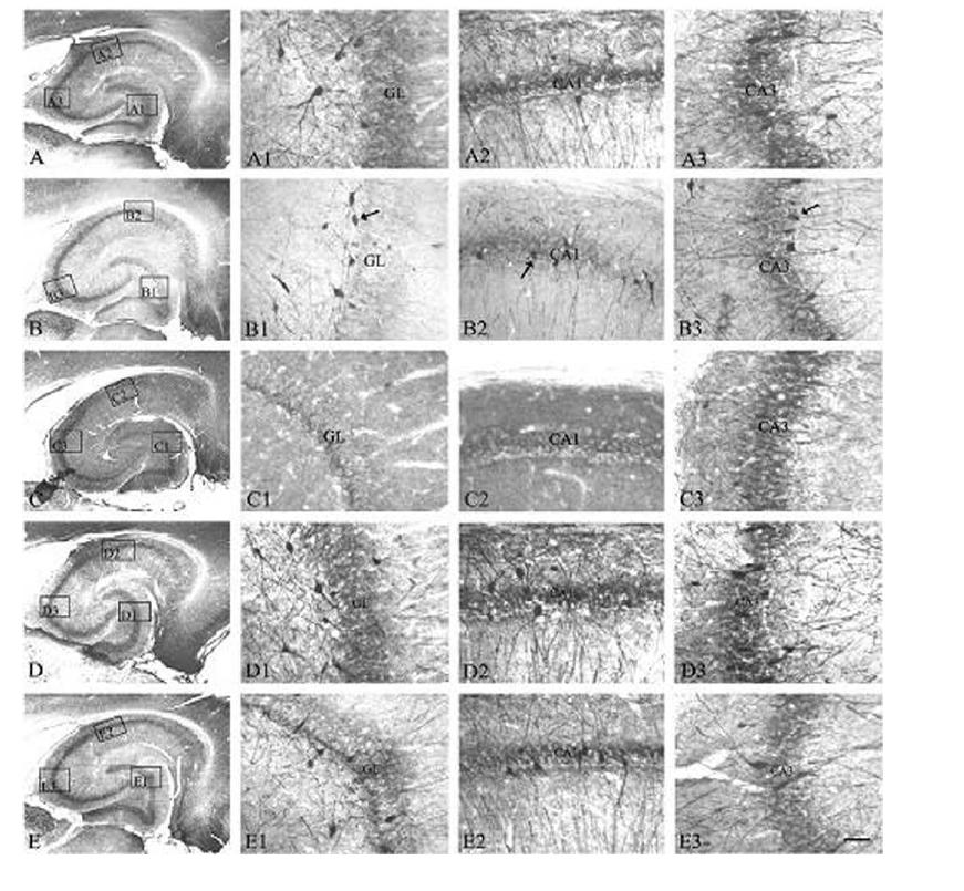 The effect of ECS on PV immunoreactivity in the rat hippocampus