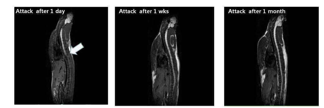 전기 척수신경손상 백서의 Manganase enhance MRI 소견의 변화