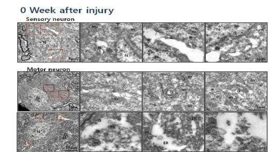 전기 손상 초기 척수신경의 전자현미경 사진