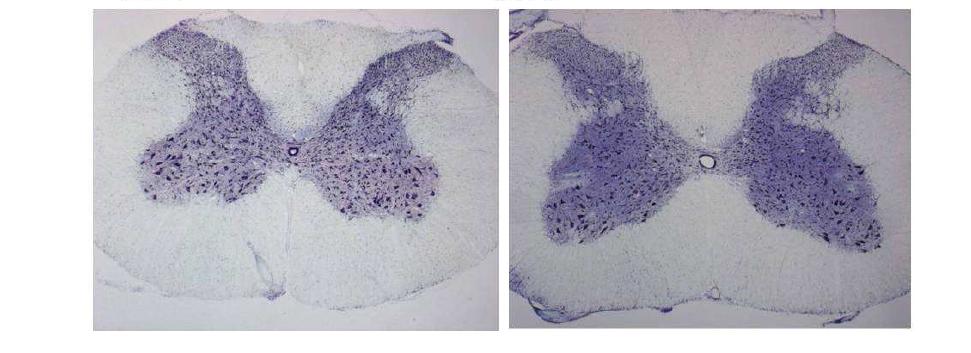 전기 척수신경손상 백서의 H&E 염색 소견