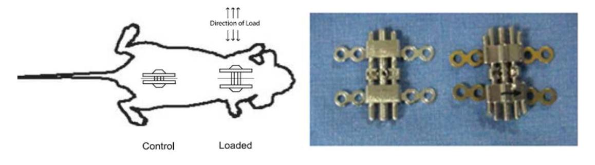 Mechanical loading device on hypertrophic scar