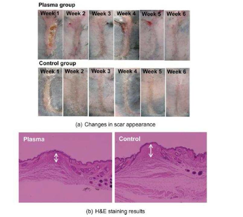 Changes in scar appearance over 6 weeks in the plasma and control groups from another mouse