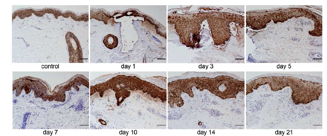 Galectin-7 expression during the wound healing process in healthy control skin.