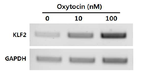 당뇨쥐 골수 줄기세포의 oxytocin 처리에 의한 KLF2의 회복