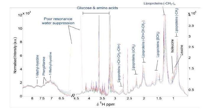 Spectral assignments, prostate cancer plasma samples (1- 10) with identifiable chemical compounds