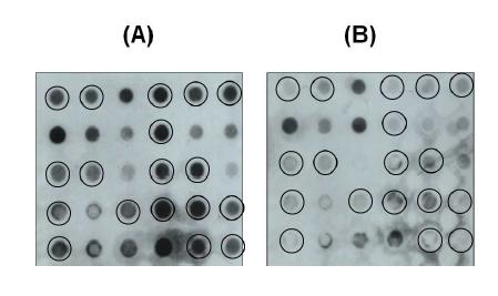 Reverse Southern dot blot hybridization을 이용한 S. mitis의 특이 유전자 발굴