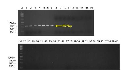 그림 46. S. mitis를 검출하기 위한 PCR 라인 1~7은 S. mitis, 라인 8~40은 S. mitis 유사균주