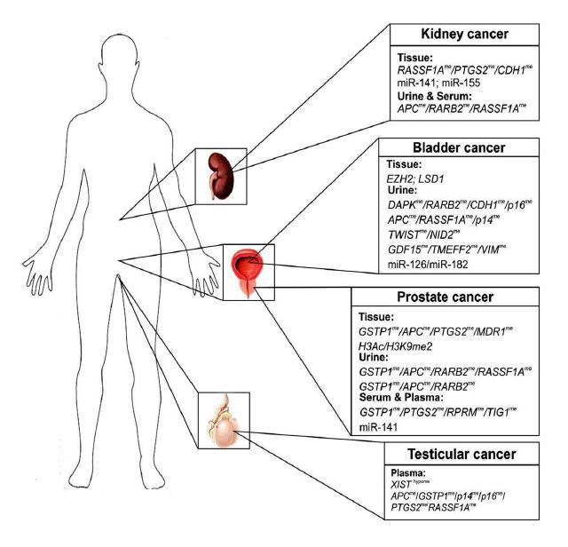 비뇨생식기 암의 주요 epigenetic biomarkers