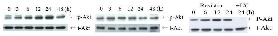 Resistin induces Akt phosphorylation in PC-3 (left) and DU145 cells (middle). LY294002 inhibits resistin-induced Akt phosphorylation in PC-3 cells (right.)