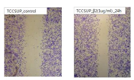 HNP-2 promotes migration of TCCSUP bladder cancer cells