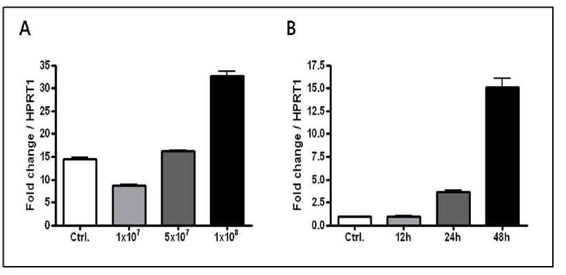 질 상피세포주 VK2/E6E7에서 L. reuteri 처리 시 CAMP 유전자의 mRNA 발현 증가 qRT-PCR 분석