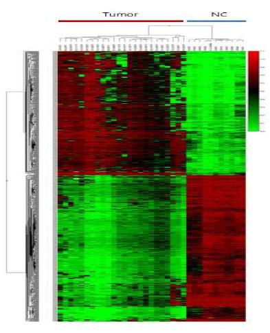 방광암 조직시료의 DNA Methylation Profiling