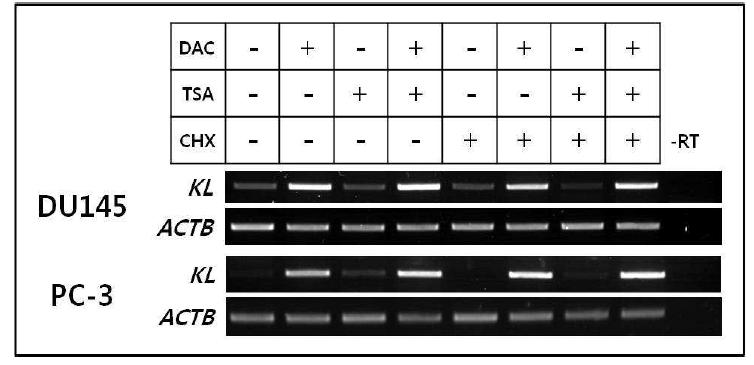 전립선암 세포주 DU145와 PC-3에 DNMT와 HDAC 저해제를 각각 처리한 후 KLOTHO(KL) mRNA의 전사 회복 조사