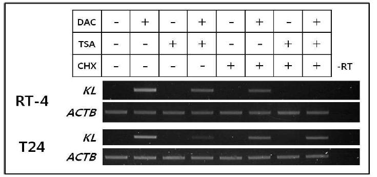 방광암 세포주 RT-4와 T24에 DNMT와 HDAC 저해제를 각각 처리한 후 KLOTHO(KL) mRNA의 전사 회복 조사