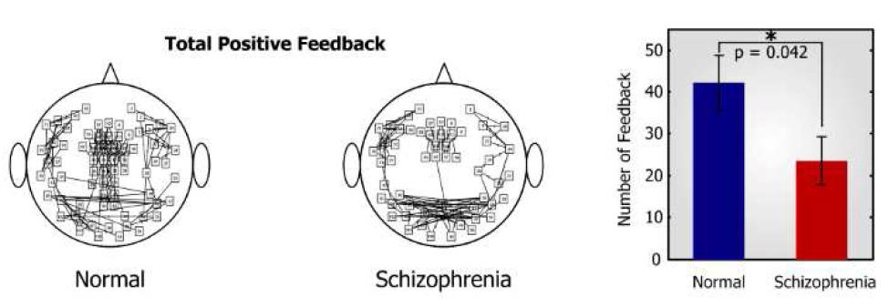 Impulse response 방법에 의한 정상군과 환자군의 feedback functional network 비교