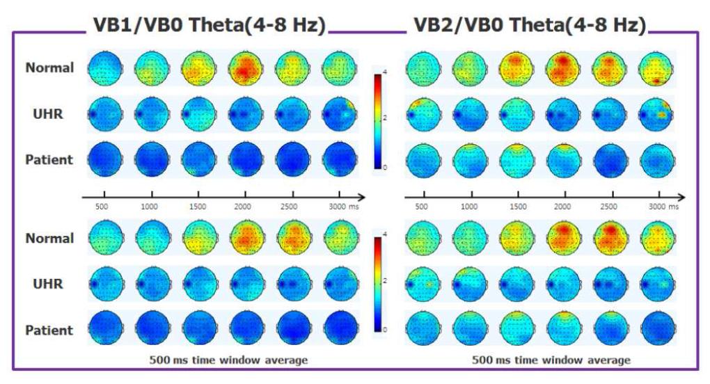 정상군, 고위험군, 환자군의 theta frequency band power topography map
