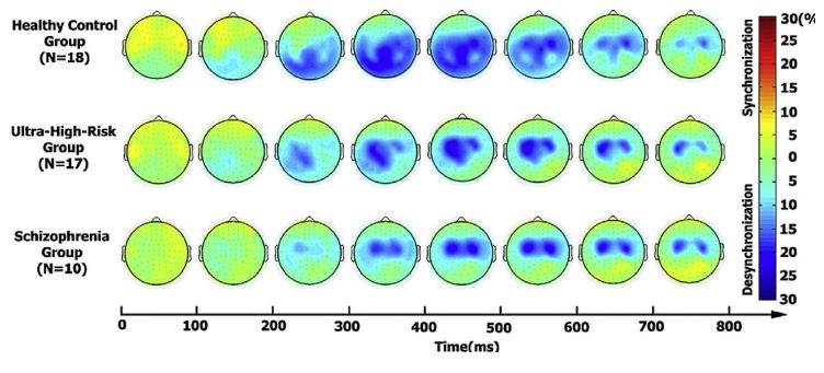 조현병 환자와고위험군 및 정상인의 알파 활성화 위상도