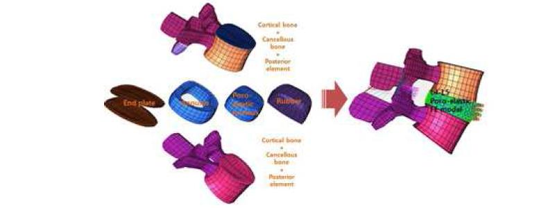 Poroelastic FE lumbar model constructed by using CT image