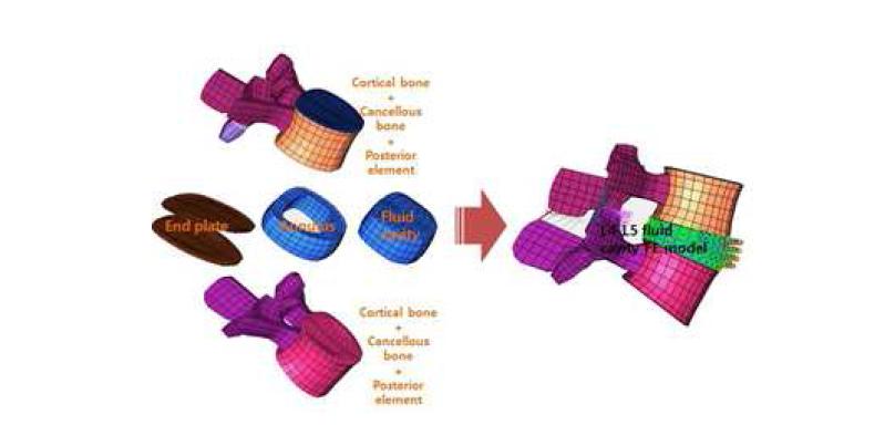 Fluid cavity FE lumbar model constructed by using CT image