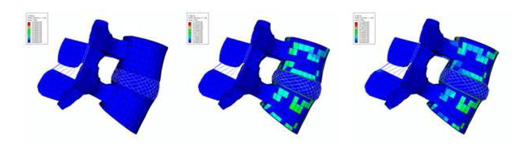 Mises stress and deformation of FE lumbar model under loading condition