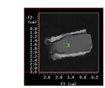 H1 MR spectroscopic analysis