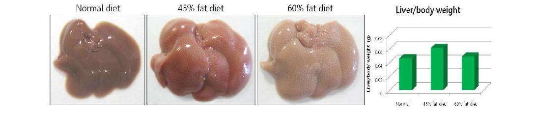 간 모양과 liver index