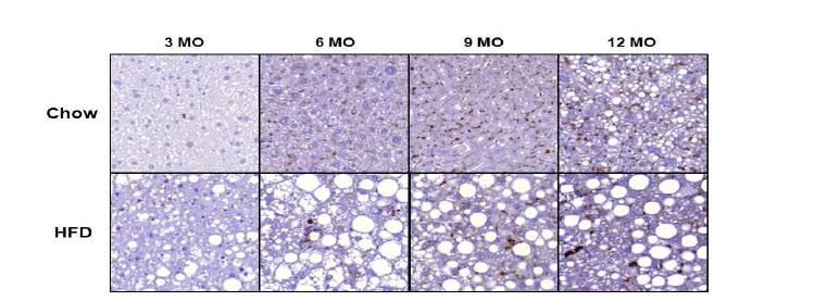 고지방 식이로부터 유도한 NASH 마우스의 간조직에서 ASXL1의 발현 확인