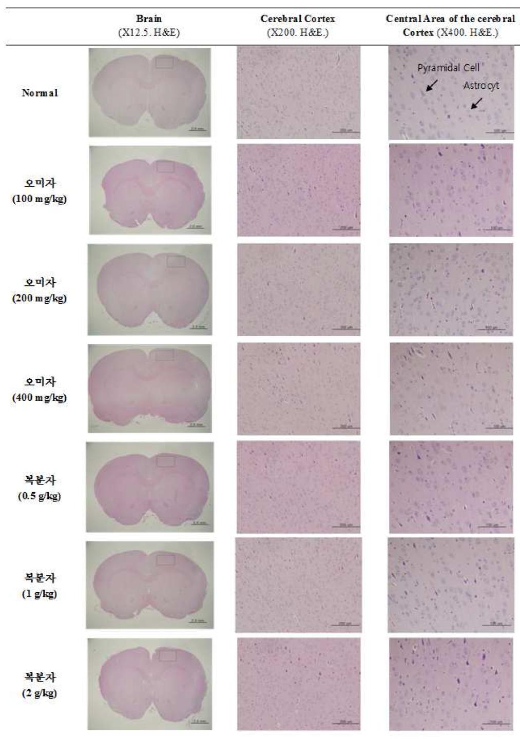 오미자, 복분자 투여 후 백서 Brain 조직의 병리조직학적 검사