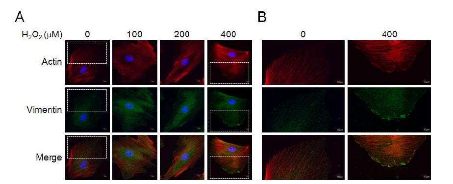 Hydrogen peroxide에 따른 actin & vimentin filament의 rearrangement