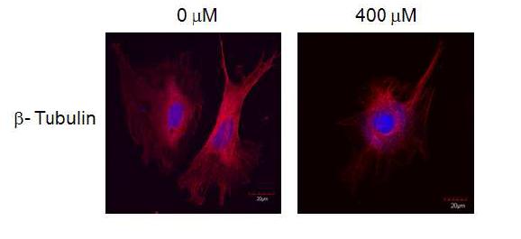 Hydrogen peroxide에 의한 microtube network의 변화