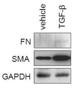 TGF-β 에 의한 ECM protein의 생성확인