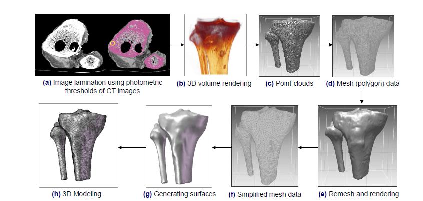 Schematic view of details about 3D reconstruction by CT images in proximal tibia part