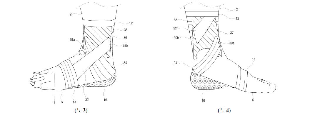 발목보조기 사시도