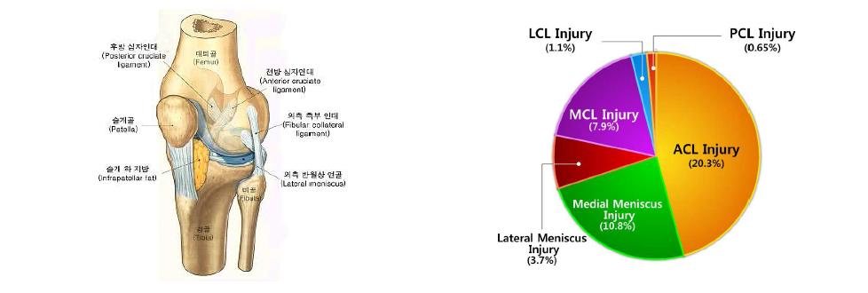 슬관절 부위별 스포츠손상 비율