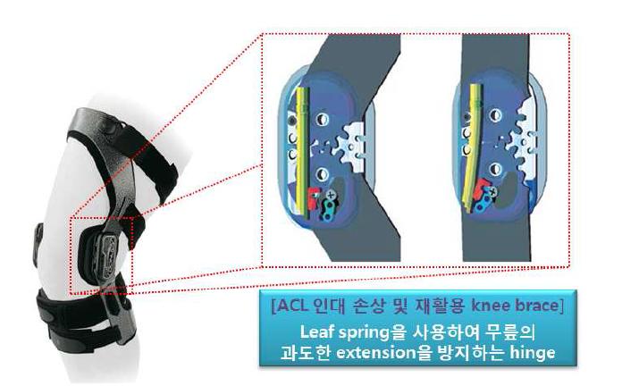 Passive 액츄에이터를 사용한 수동적 ROM 제한 기능을 가진 functional brace