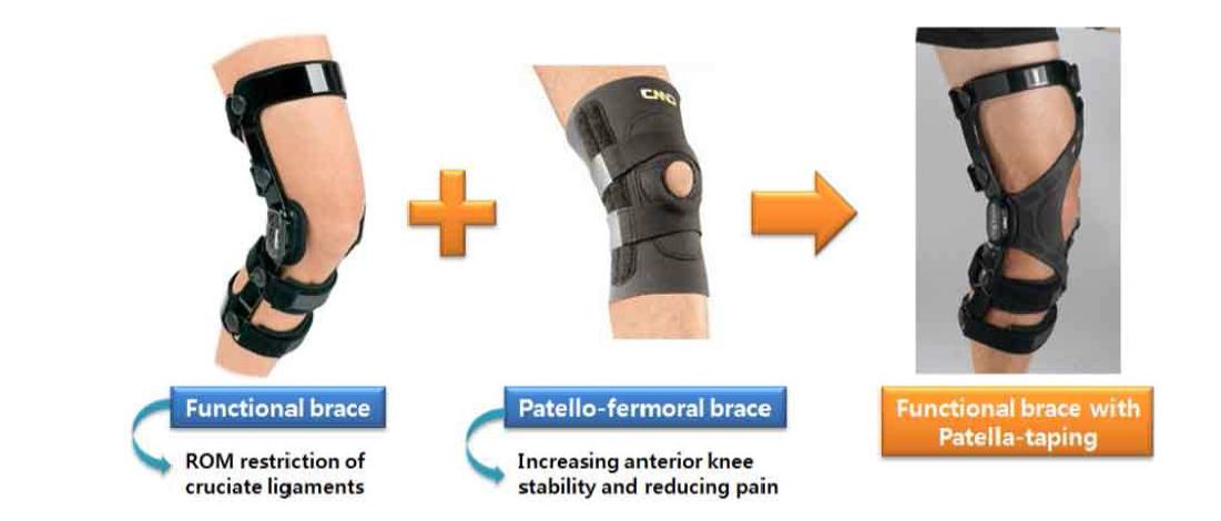 Functional knee brace와 patella taping 기법의 융합을 통한 치료 효과 증대