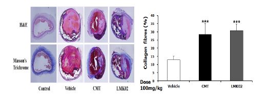 CMT와 LMK02에 대한 경동맥혈관손상 조직사진 및 손상 혈관내 콜라겐 정량