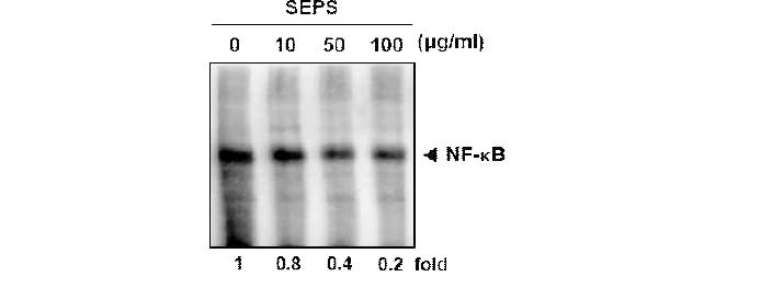 SEPS inhibits constitutive NF-kB activation in breast cancer cells.