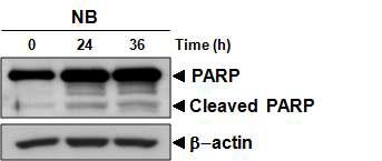 Nobiletin induces apoptosis by PARP cleavage.