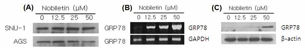 RT-PCR and Western blot analysis of protein expression in gastric cancer cells.