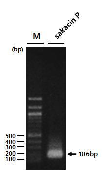 Agarose gel electrophoresis analysis of PCR products amplified from genomic DNA of ALH. Lane M represents a DNA size marker.