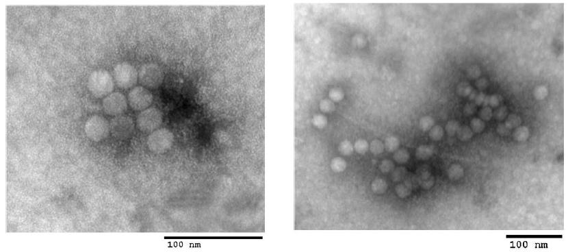 SBV 양성으로 판명된 꿀벌 유충 시료 내 Korean Sacbrood virus(KSBV)의 Transmission electron microscopy 촬영사진, picornavirus와 형태적 유사성을 지닌 27.8±0.4 nm 크기의 바이러스 입자들을 확인