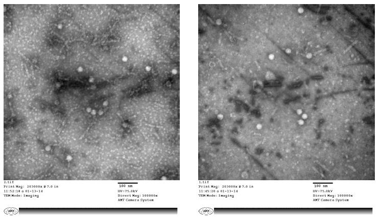 인공감염 꿀벌 유충 내 Korean Sacbrood virus (KSBV)의 Transmission electron microscopy 촬영사진, picornavirus와 형태적 유사성을 지닌 27.8±0.4nm 크기의 바이러스 입자들을 확인
